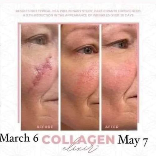 Collagen Elixir - Image 4