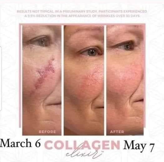 Collagen Elixir - Image 4