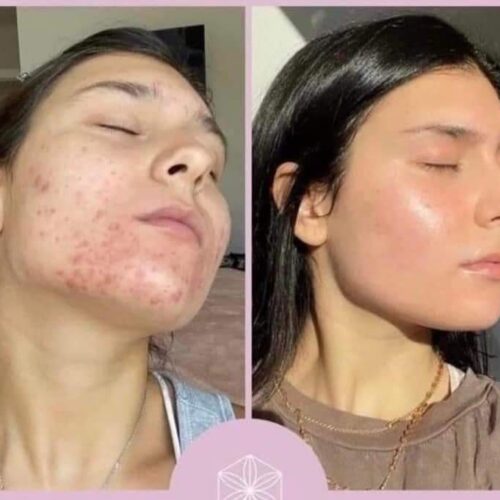 Collagen Elixir - Image 3