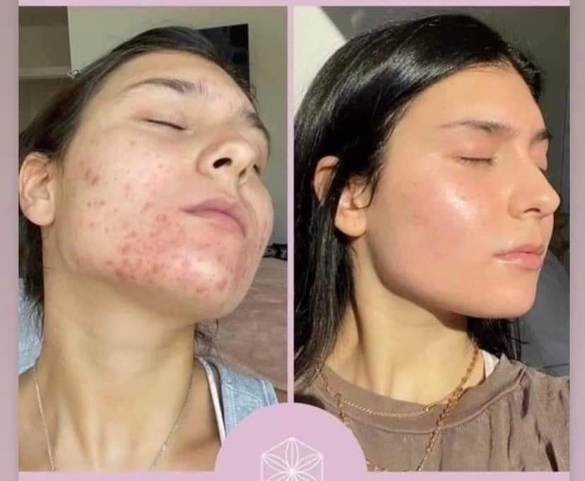 Collagen Elixir - Image 3